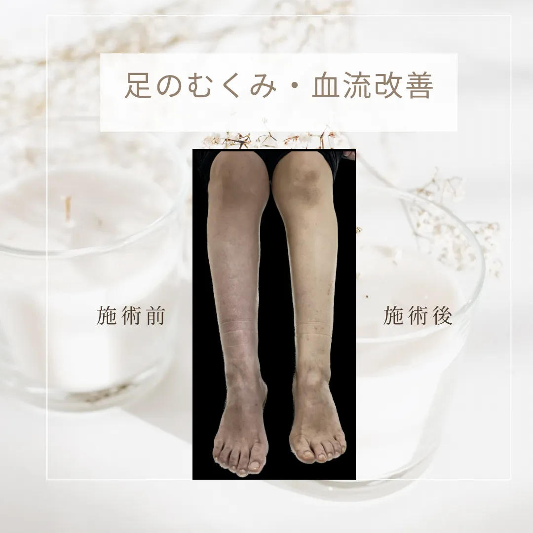 足のむくみ・血流改善
